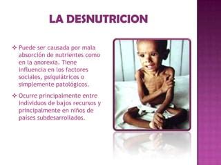 que es la desnutricion - que es una capsula del tiempo